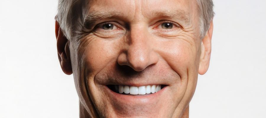 How Much Does a Full Set of Veneers Cost? A Complete Guide