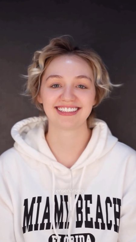 Porcelain Veneers Testimonial, Miami Cosmetic Surgery