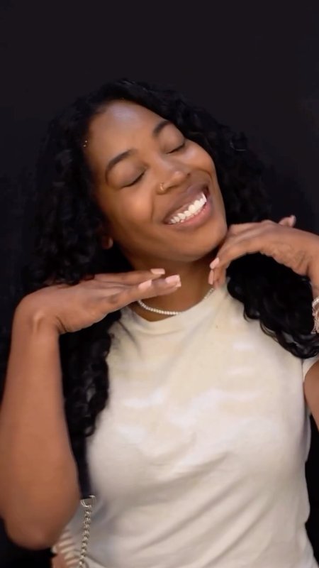 Porcelain Veneers Testimonial, Miami Cosmetic Surgery