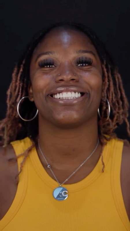 Dental Implants & Porcelain Veneers Transformation