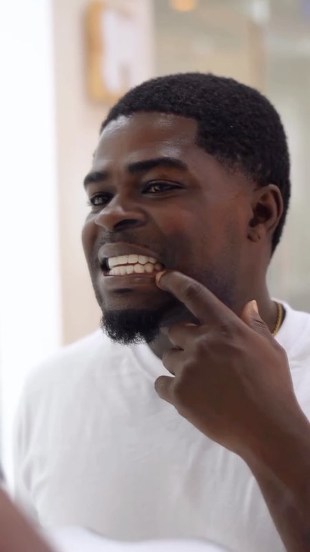 The Truth About My Porcelain Veneers Experience