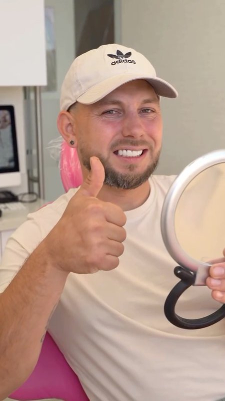 A Look at Her Porcelain Veneers Transformation