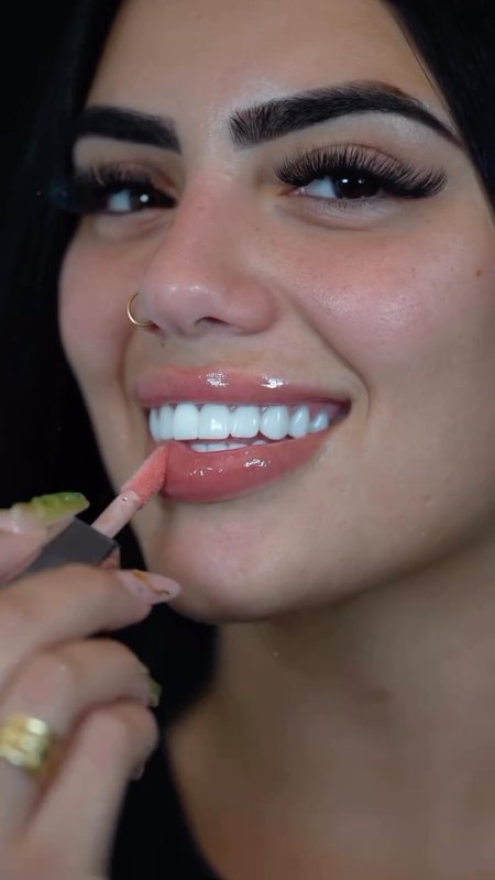 CG Smile Patient Journey: Bridges & Porcelain Veneers