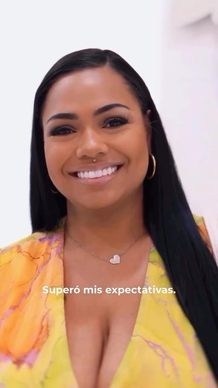 Bridges & Porcelain Veneers Review, What to Expect