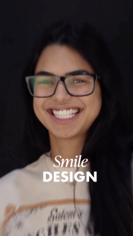 Real Story: Porcelain Veneers in Miami