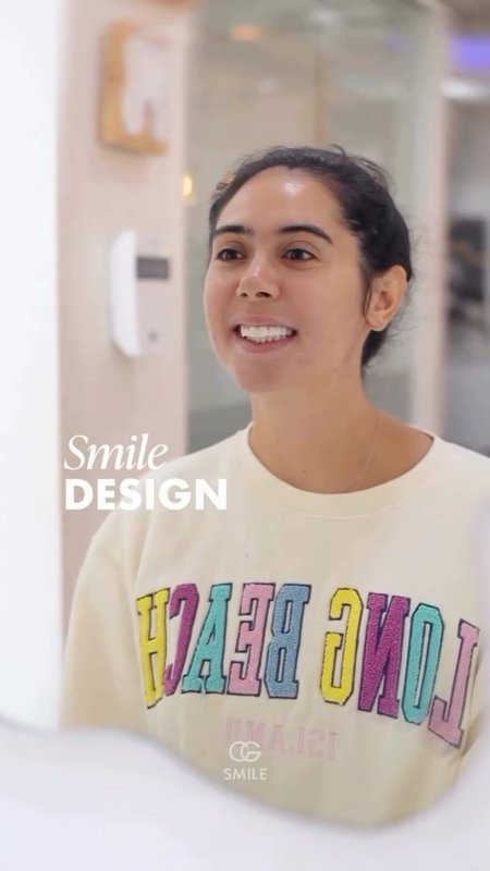 Patient Testimonial, Porcelain Veneers at CG Smile